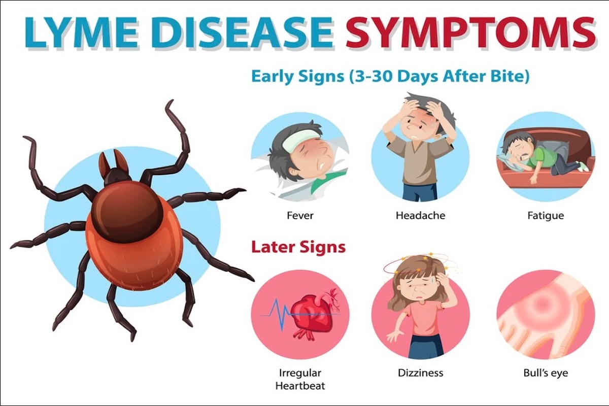 Lyme Disease Neurological Symptoms: Understanding the Neurological Impact