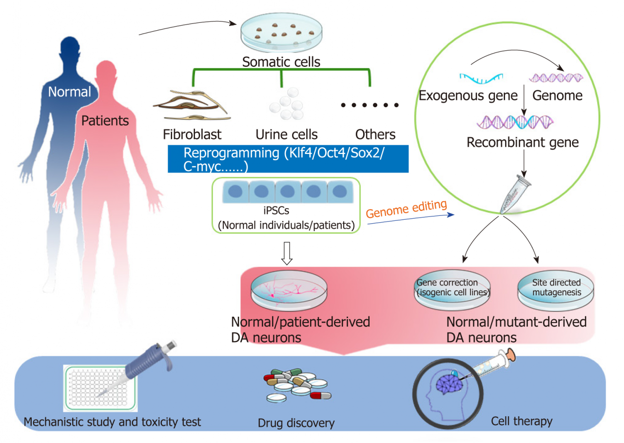 Success rate of stem cell therapy for parkinson's disease